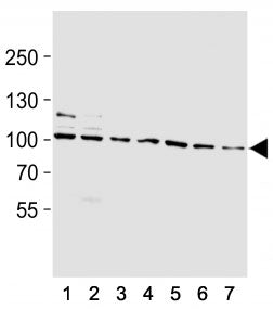 Western blot analysis of lysate from (1) rat L6, (2) mouse NIH3T3, (3) T47D, (4) A2058, (5) HepG2, (