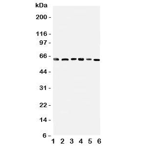 Western blot testing of PDK1 antbody on Lane 1: rat heart; 2: (r) skeletal muscle; and human samples