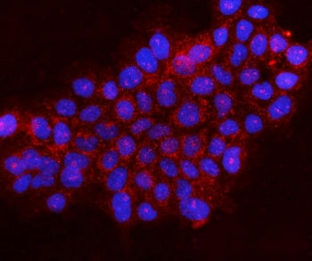 Gephyrin Antibody / GPHN