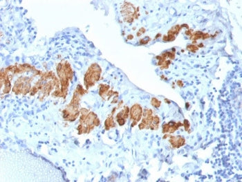 SMMHC Antibody (Smooth Muscle Myosin Heavy Chain)