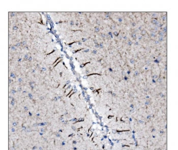 Alpha Internexin Antibody / INA / Neurofilament-66
