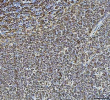 IHC staining of FFPE human tonsil tissue with Histone deacetylase 1 antibody. HIER: boil tissue sect
