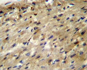 ABCD2 antibody immunohistochemistry analysis in formalin fixed and paraffin embedded human heart tis