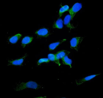 Radixin Antibody / RDX