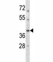 RAD51C Antibody