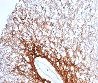 IHC staining of FFPE human cerebellum tissue with GFAP antibody (clone GFAP/6879). HIER: boil tissue