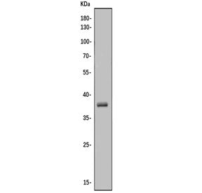 CA10 Antibody / Carbonic Anhydrase X