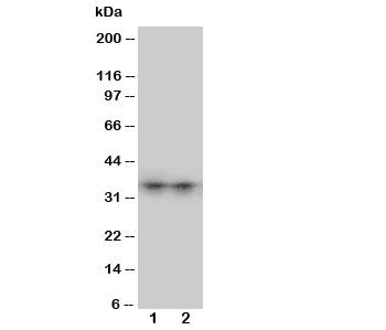 Western blot testing of Aquaporin 8 antibody and Lane 1: SW620; 2: COLO320 cell lysate. The ~27 kDa protein may be visualized at higher molecular weights due to glycosylation.