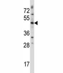 WNT3 antibody western blot analysis in CEM lysate. Predicted molecular weight 39~65 kDa depending on