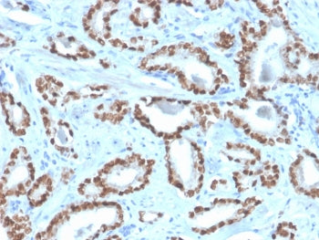 NKX3.1 Antibody