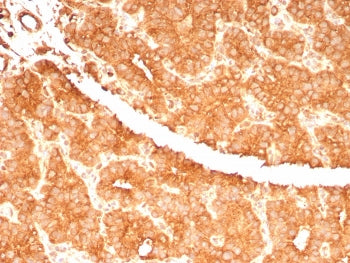 IHC staining of FFPE human parathyroid gland tissue with c-RET Proto-oncogene antibody (clone RET/76