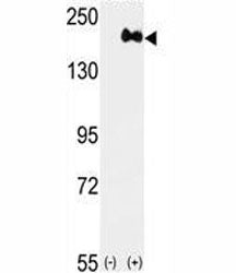 HER2 Antibody