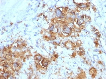 CA19-9 Antibody