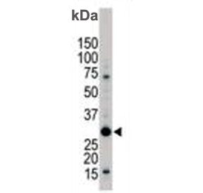 14-3-3 beta/alpha Antibody / YWHAB