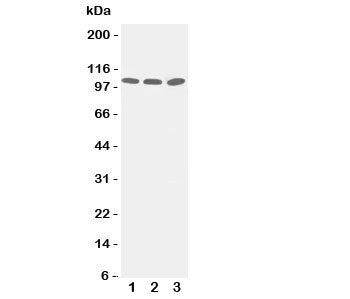 Western blot testing of ZO-3 antibody and Lane 1: PANC; 2: A549; 3: HeLa cell lysate. Predicted/obse