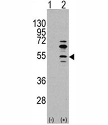 MEF2C Antibody