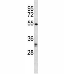 RIPK3 Antibody