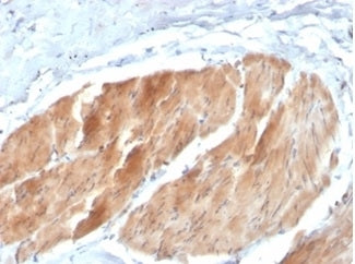 PIK3R2 / PI3K Antibody (p85 beta)