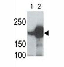 LRP5 Antibody