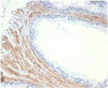 IHC staining of FFPE human prostate tissue with recombinant Aciculin antibody (clone PGM5/7005R) at 