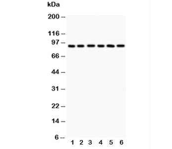 Western blot testing of TLR1 antibody and Lane 1: COLO320; 2: SW620; 3: SKOV; 4: Jurkat; 5: CEM; 6: 