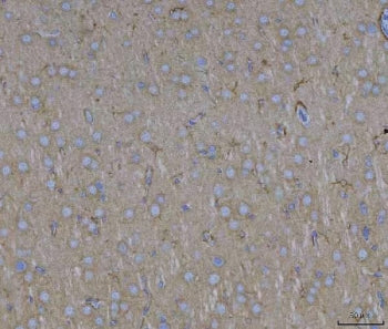 IHC staining of FFPE rat brain tissue with ADAM22 antibody. HIER: boil tissue sections in pH8 EDTA f