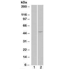 HEK293 overexpressing ILPIP/STRADB (lane 2) tested with STRADB antibody (lane 1-mock transfection). 