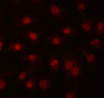 Immunofluorescent staining of FFPE human A549 cells with PRPF39 antibody. HIER: steam section in pH6