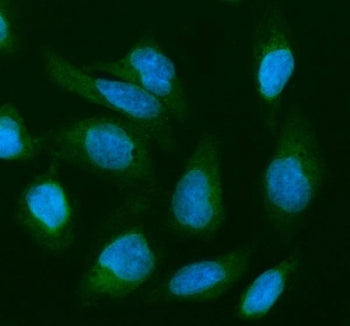 Immunofluorescent staining of FFPE human U-2 OS cells with Cofilin 2 antibody (green) and DAPI nucle