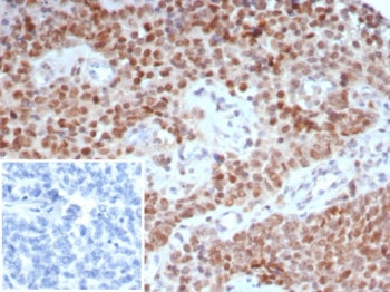 IHC staining of FFPE human ovary tissue with TRPS1 antibody (clone TRPS1/7912R). Inset: PBS used in 
