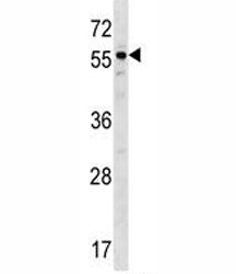 BMP3 Antibody