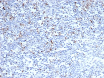 CTLA-4 Antibody / CD152