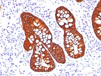 KRT19 Antibody Cocktail / Cytokeratin 19