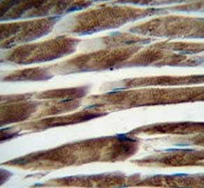 ILKAP Antibody