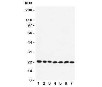 Western blot testing of RAB9 antibody and Lane 1: rat brain; 2: mouse brain; 3: human HeLa; 4: (r) P