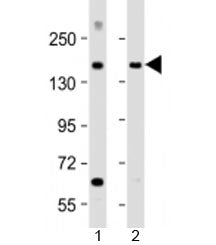 Western blot testing of human 1) brain and 2) lung lysate with MTUS1 antibody at 1:2000. Predicted m