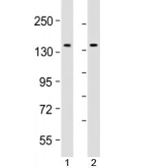 Western blot testing of human 1) Jurkat and 2) K562 cell lysate with TACC3 antibody at 1:2000. Expec