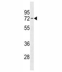 Estrogen Receptor Antibody