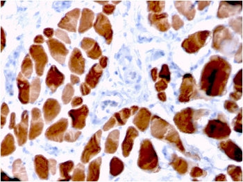 IHC staining of FFPE human skeletal muscle tissue with Actinin Alpha 2 antibody (clone ACTN2/3294). 
