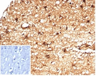 IHC staining of FFPE human brain tissue with recombinant Aldehyde Dehydrogenase 1A1 antibody (clone 