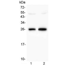 MOG Antibody / Myelin Oligodendrocyte Glycoprotein