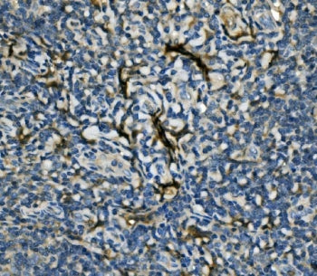 EIF4A1 Antibody