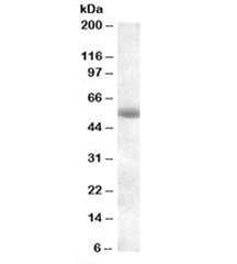 Western blot testing of human pancreas lysate with TMPRSS2 antibody at 0.1ug/ml. Predicted molecular