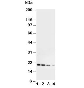 Western blot testing of mouse Il-10 antibody and Lane 1: Recombinant mouse protein 10ng; 2: 5ng; 3: 