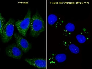 ATG5 Antibody