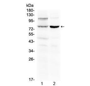 Western blot testing of 1) rat liver and 2) mouse kidney lysate with Dishevelled 2 antibody at 0.5ug