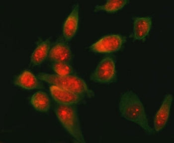 Immunofluorescent staining of FFPE human SiHa cells with ATF6 antibody (red) and Beta Tubulin mAb (g
