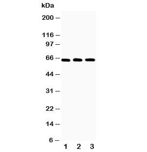 RANK Antibody
