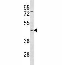 FOXP3 Antibody