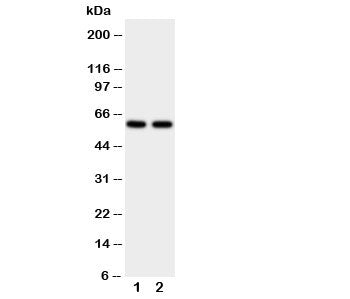 Western blot testing of CYP11A1 antibody and human placenta tissue lysate. Expected molecular weight